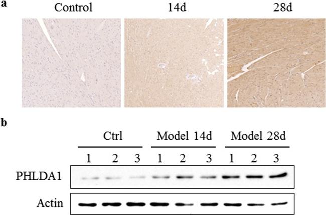 PHLDA1 Antibody in Western Blot (WB)