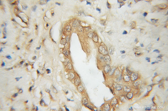 STT3A Antibody in Immunohistochemistry (Paraffin) (IHC (P))