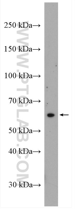 STT3A Antibody in Western Blot (WB)