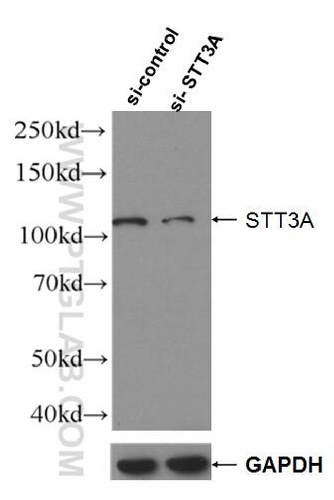 STT3A Antibody in Western Blot (WB)