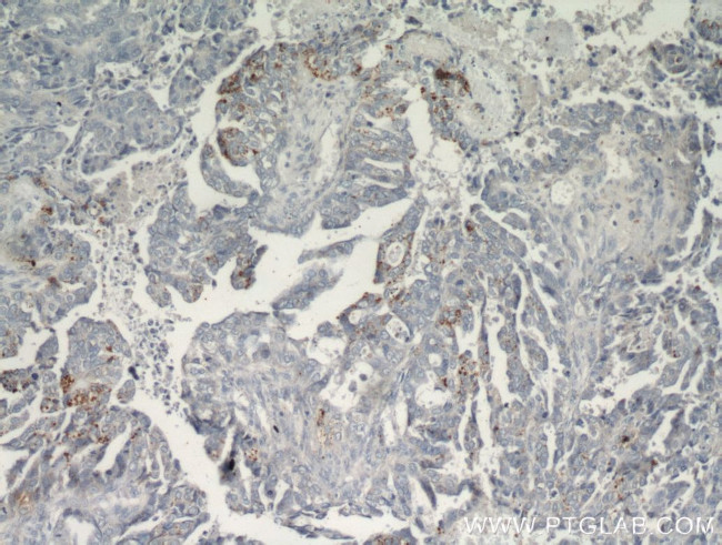 CHI3L1 Antibody in Immunohistochemistry (Paraffin) (IHC (P))