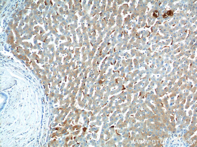 CHI3L1 Antibody in Immunohistochemistry (Paraffin) (IHC (P))