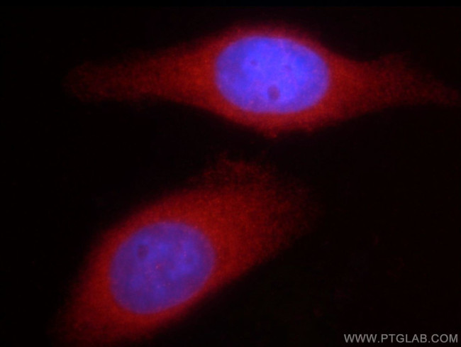 DVL2 Antibody in Immunocytochemistry (ICC/IF)