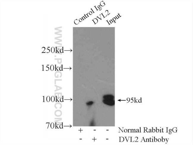 DVL2 Antibody in Immunoprecipitation (IP)