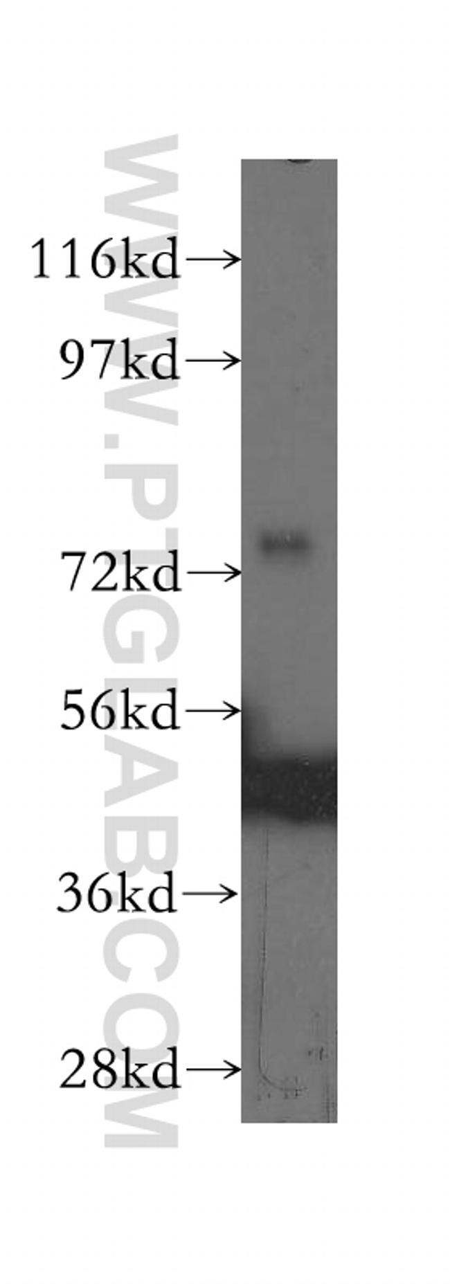 DVL2 Antibody in Western Blot (WB)