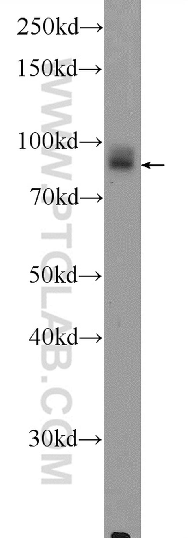 DVL2 Antibody in Western Blot (WB)