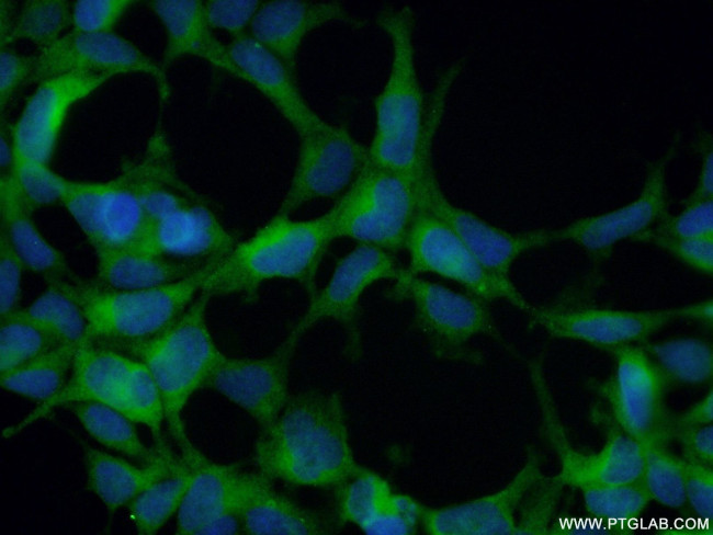 HURP Antibody in Immunocytochemistry (ICC/IF)