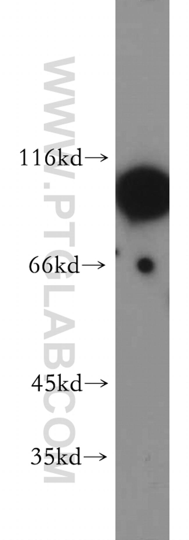 HURP Antibody in Western Blot (WB)