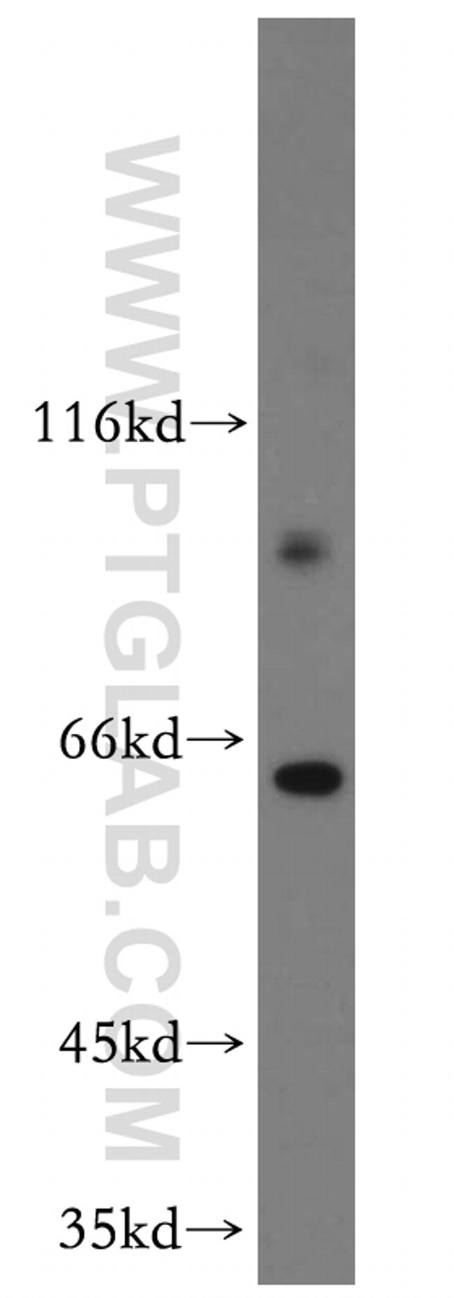 HURP Antibody in Western Blot (WB)