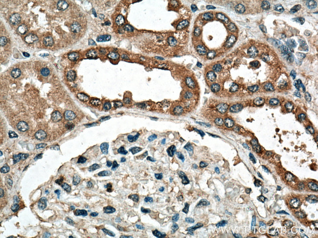 DISP1 Antibody in Immunohistochemistry (Paraffin) (IHC (P))