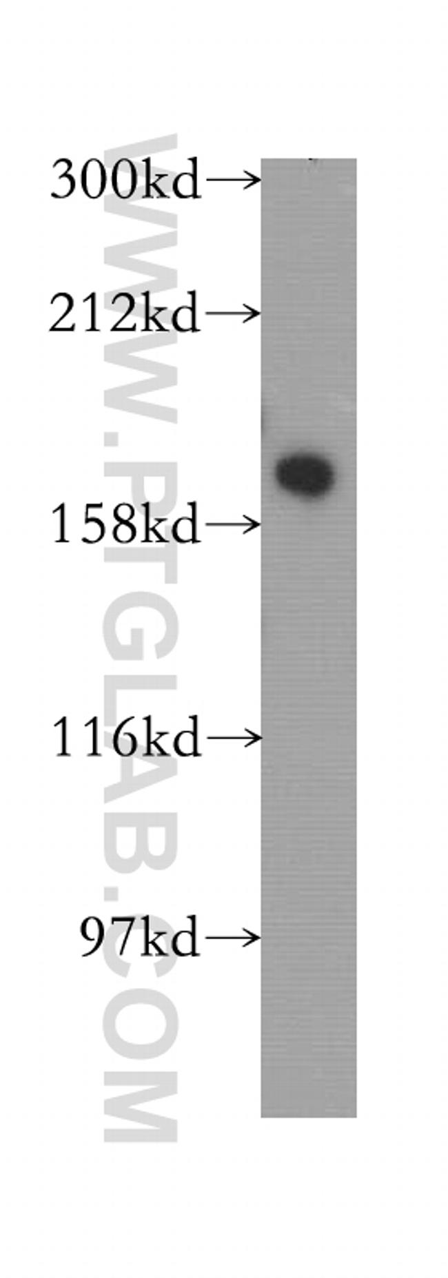 DISP1 Antibody in Western Blot (WB)