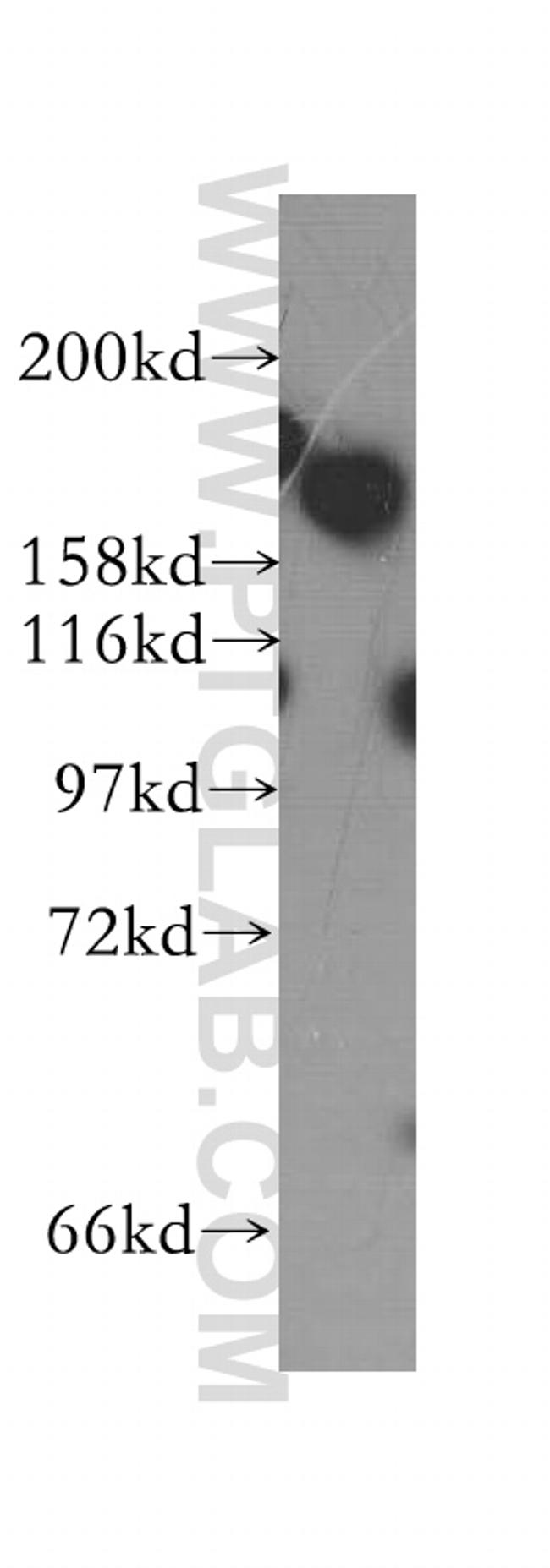 DISP1 Antibody in Western Blot (WB)