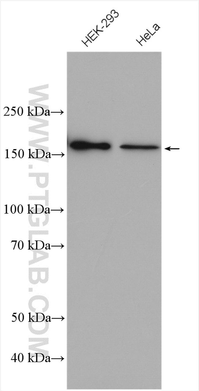 DISP1 Antibody in Western Blot (WB)