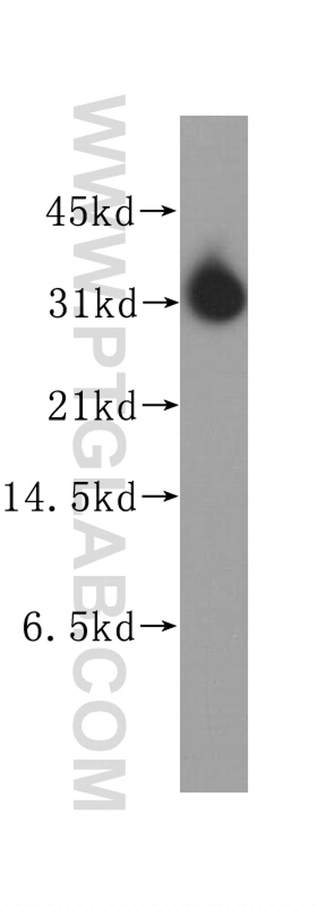 STOM Antibody in Western Blot (WB)