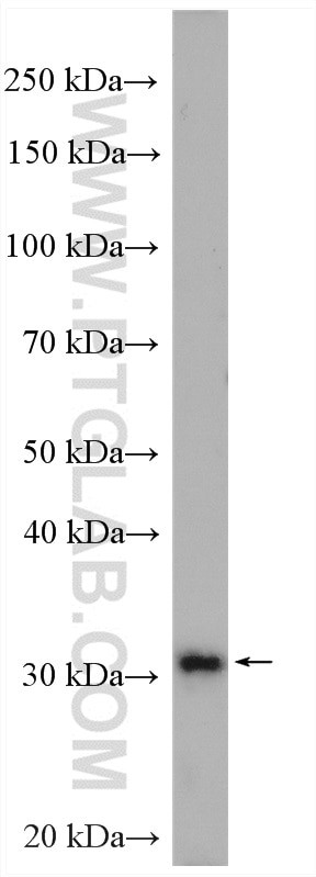 STOM Antibody in Western Blot (WB)