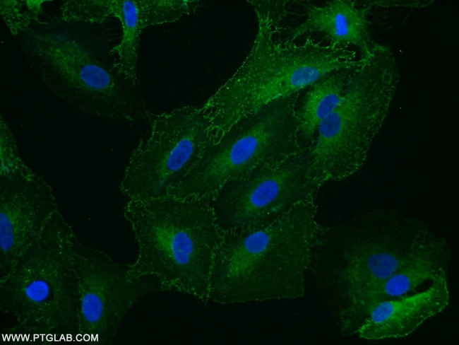 STOM Antibody in Immunocytochemistry (ICC/IF)