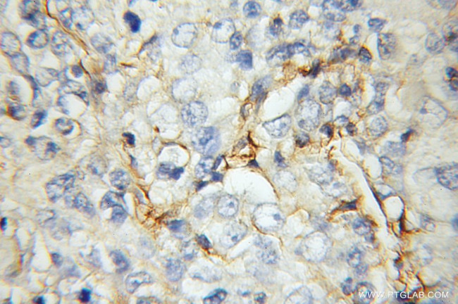 STOM Antibody in Immunohistochemistry (Paraffin) (IHC (P))