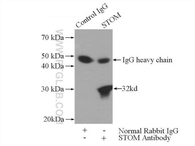 STOM Antibody in Immunoprecipitation (IP)