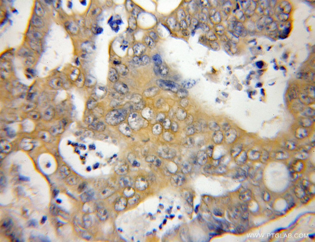 SLU7 Antibody in Immunohistochemistry (Paraffin) (IHC (P))