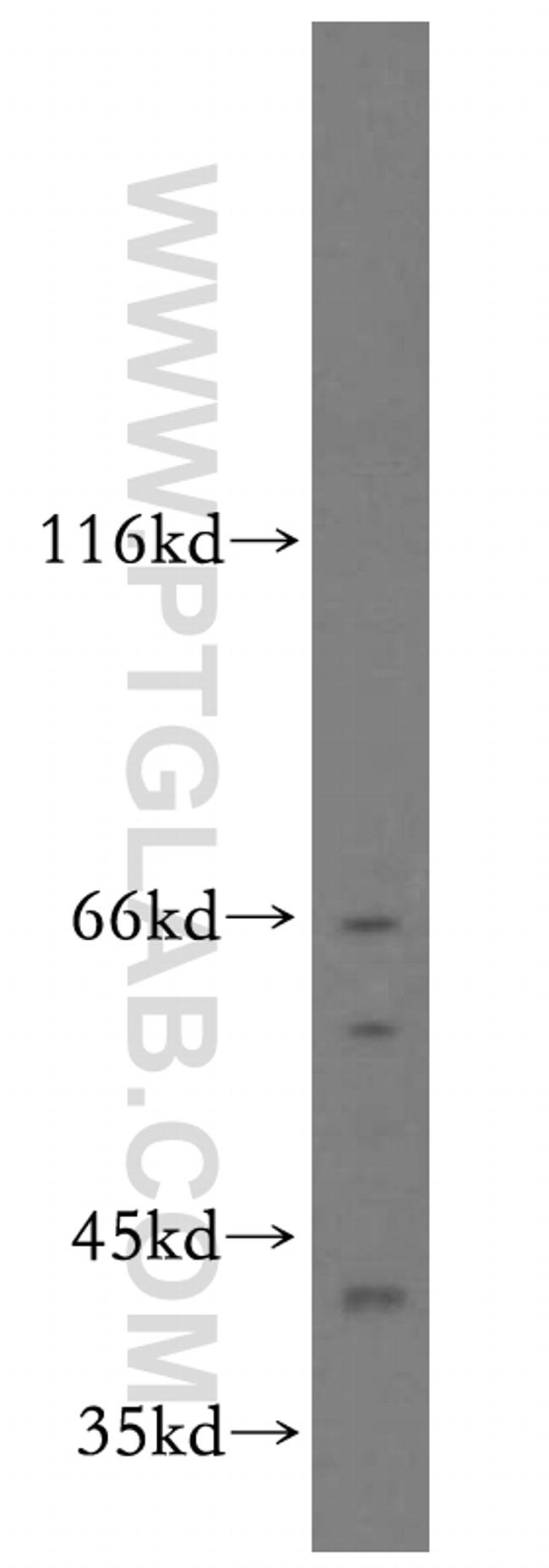 SLU7 Antibody in Western Blot (WB)