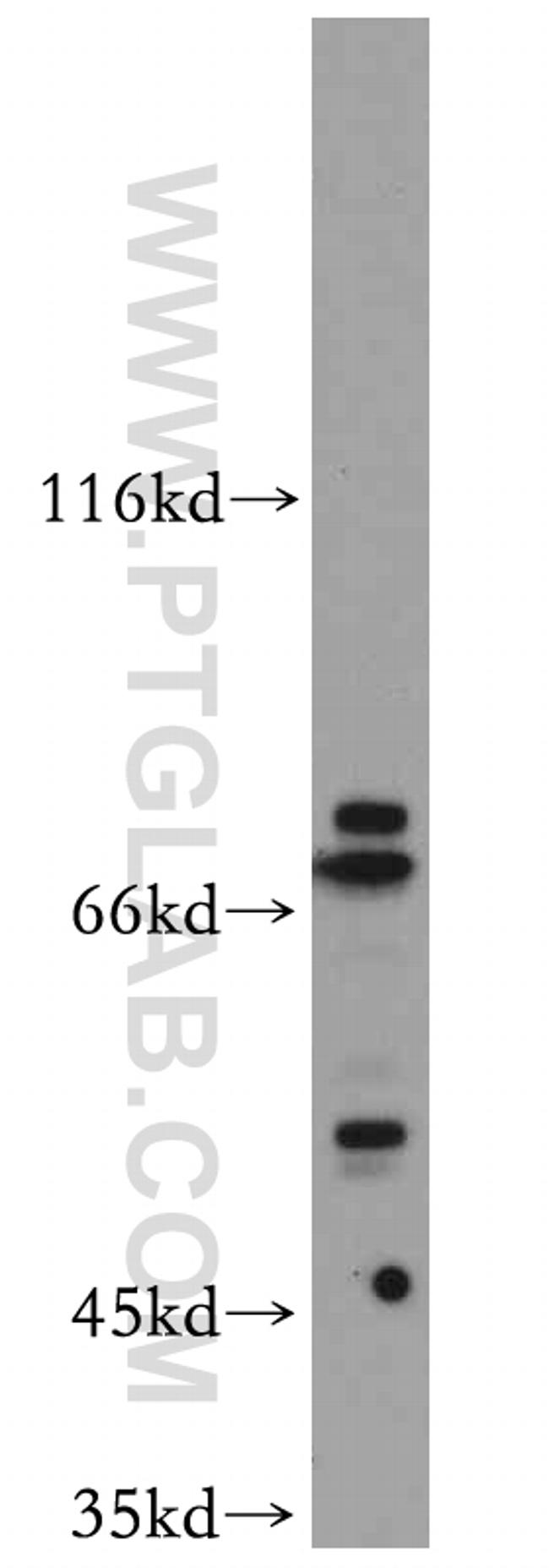 SLU7 Antibody in Western Blot (WB)