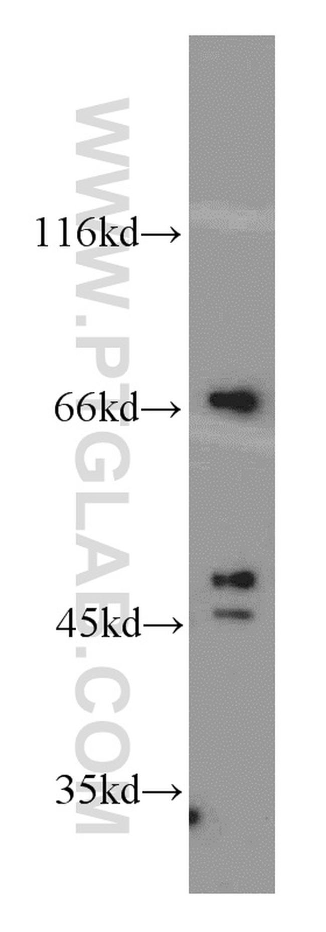 SLU7 Antibody in Western Blot (WB)