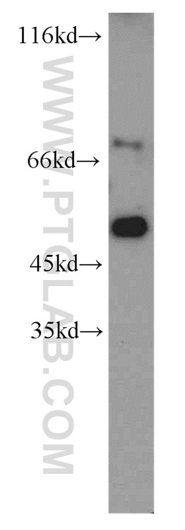 SLU7 Antibody in Western Blot (WB)