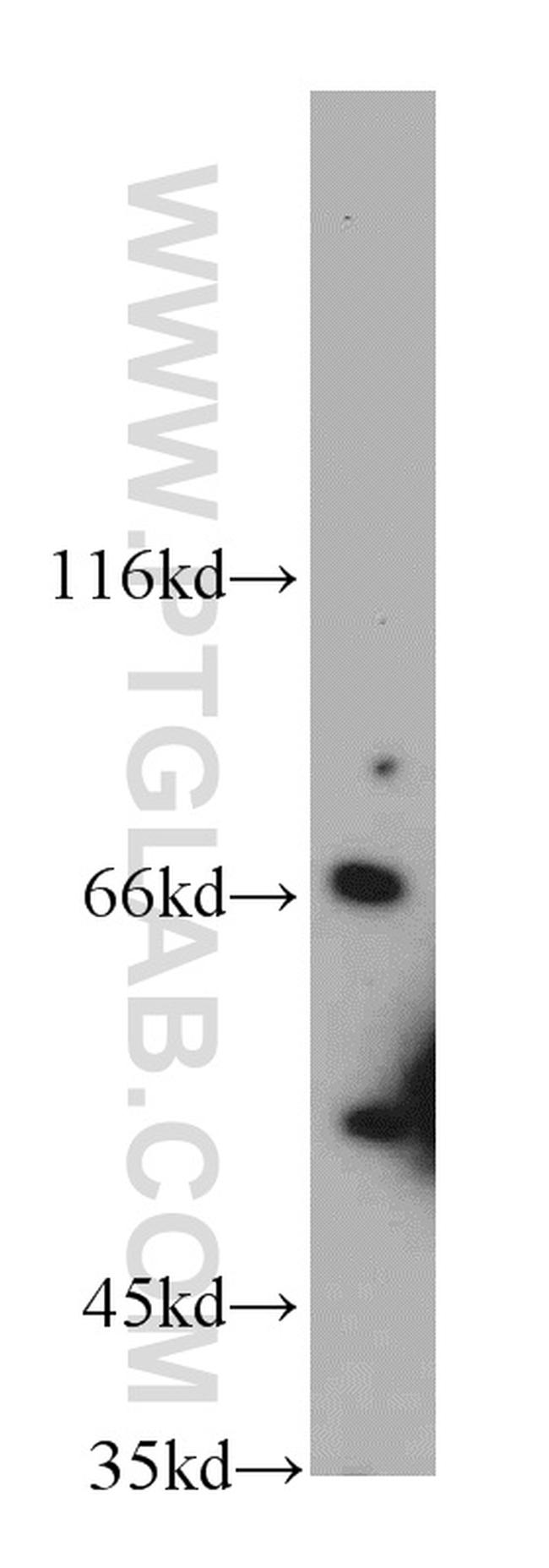 SLU7 Antibody in Western Blot (WB)