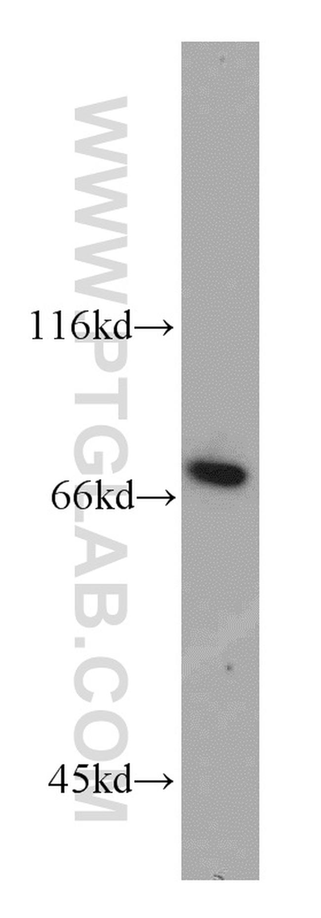 SLU7 Antibody in Western Blot (WB)