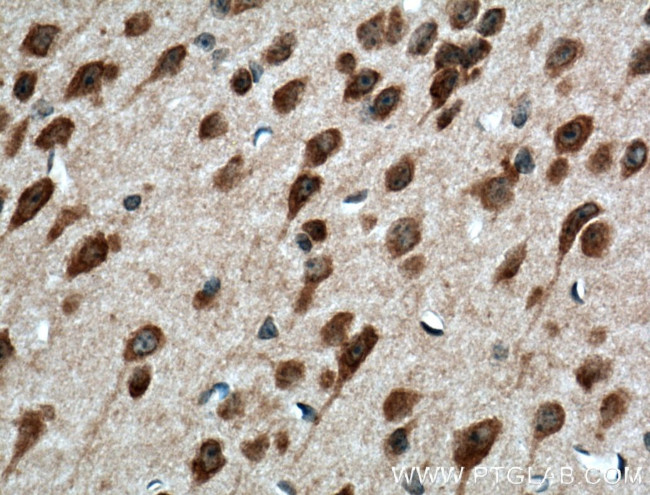 PELI1 Antibody in Immunohistochemistry (Paraffin) (IHC (P))