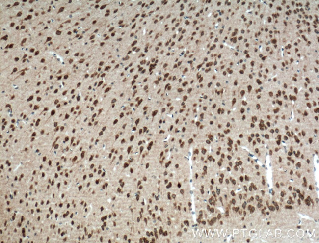 PELI1 Antibody in Immunohistochemistry (Paraffin) (IHC (P))