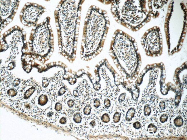 PSMD3 Antibody in Immunohistochemistry (Paraffin) (IHC (P))