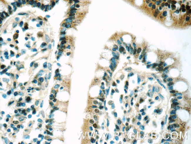 PSMD3 Antibody in Immunohistochemistry (Paraffin) (IHC (P))