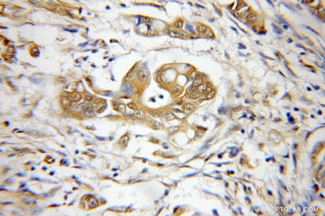 PSMD3 Antibody in Immunohistochemistry (Paraffin) (IHC (P))