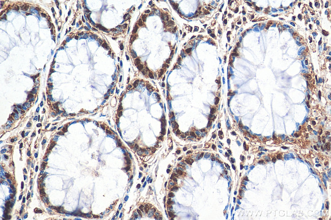 PSMD3 Antibody in Immunohistochemistry (Paraffin) (IHC (P))