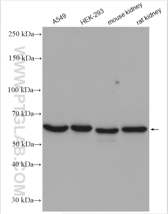 PSMD3 Antibody in Western Blot (WB)