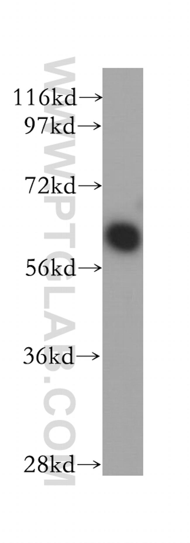 PSMD3 Antibody in Western Blot (WB)