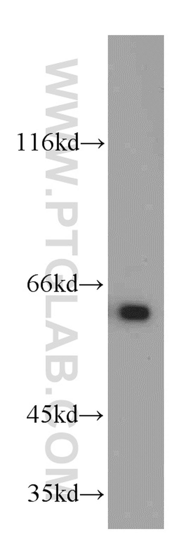 PSMD3 Antibody in Western Blot (WB)