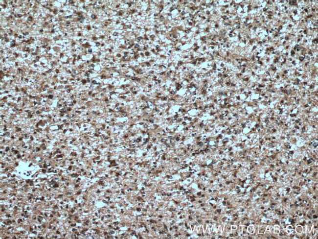 RTN3 Antibody in Immunohistochemistry (Paraffin) (IHC (P))