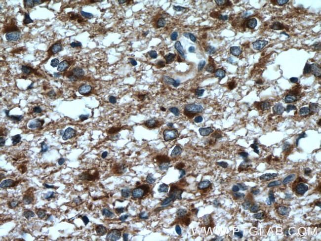 RTN3 Antibody in Immunohistochemistry (Paraffin) (IHC (P))