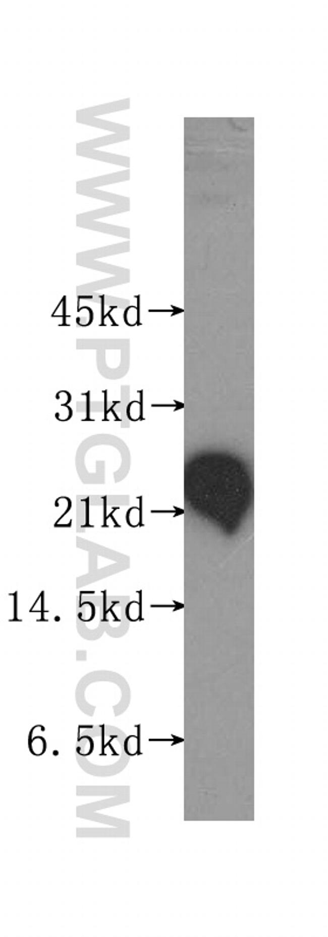 RTN3 Antibody in Western Blot (WB)