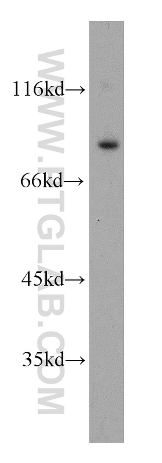 ODF2 Antibody in Western Blot (WB)