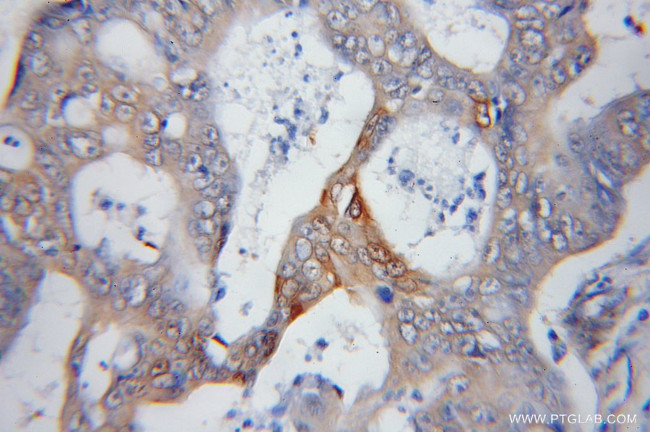 PSMD14/POH1 Antibody in Immunohistochemistry (Paraffin) (IHC (P))