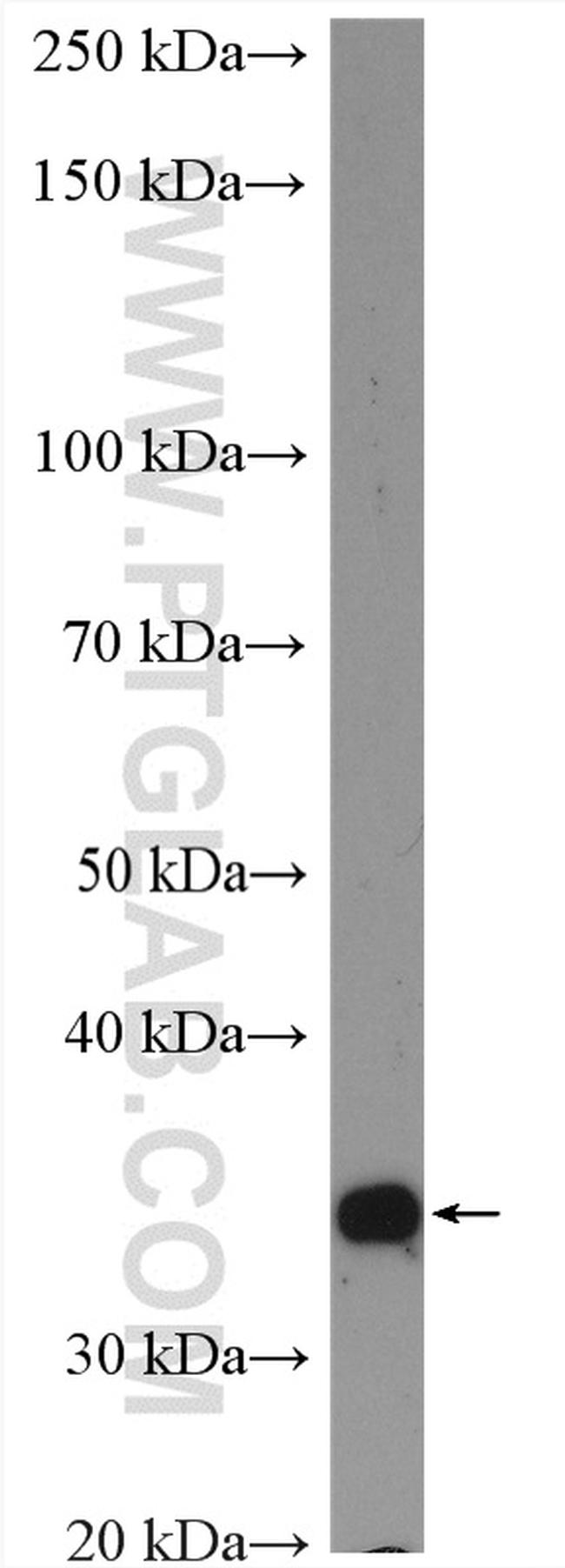 PSMD14/POH1 Antibody in Western Blot (WB)