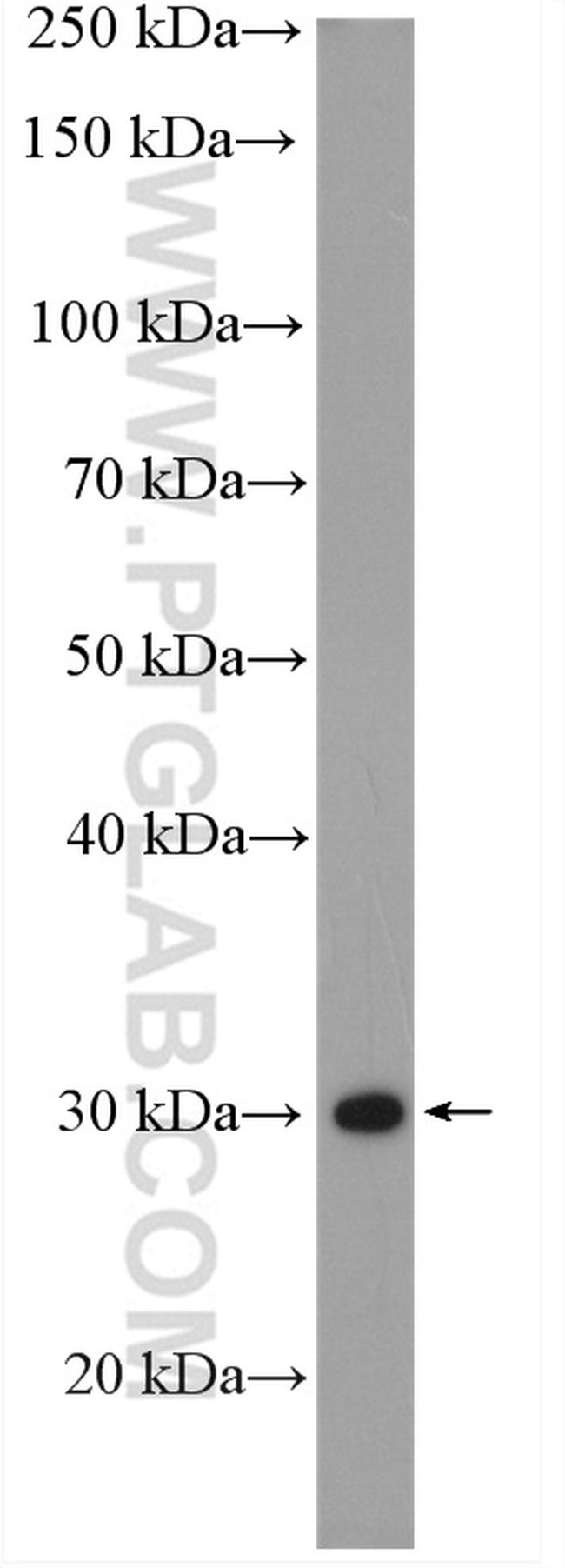 PSMD14/POH1 Antibody in Western Blot (WB)