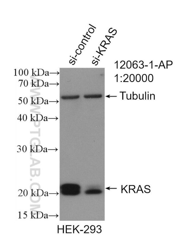 KRAS Antibody in Western Blot (WB)