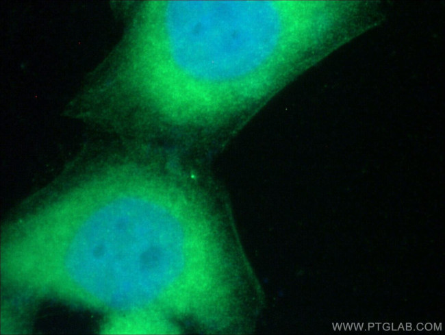 KRAS Antibody in Immunocytochemistry (ICC/IF)