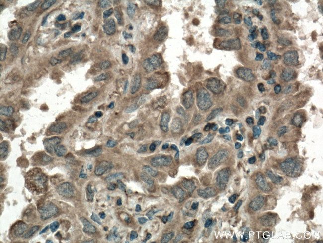 KRAS Antibody in Immunohistochemistry (Paraffin) (IHC (P))