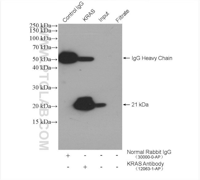 KRAS Antibody in Immunoprecipitation (IP)