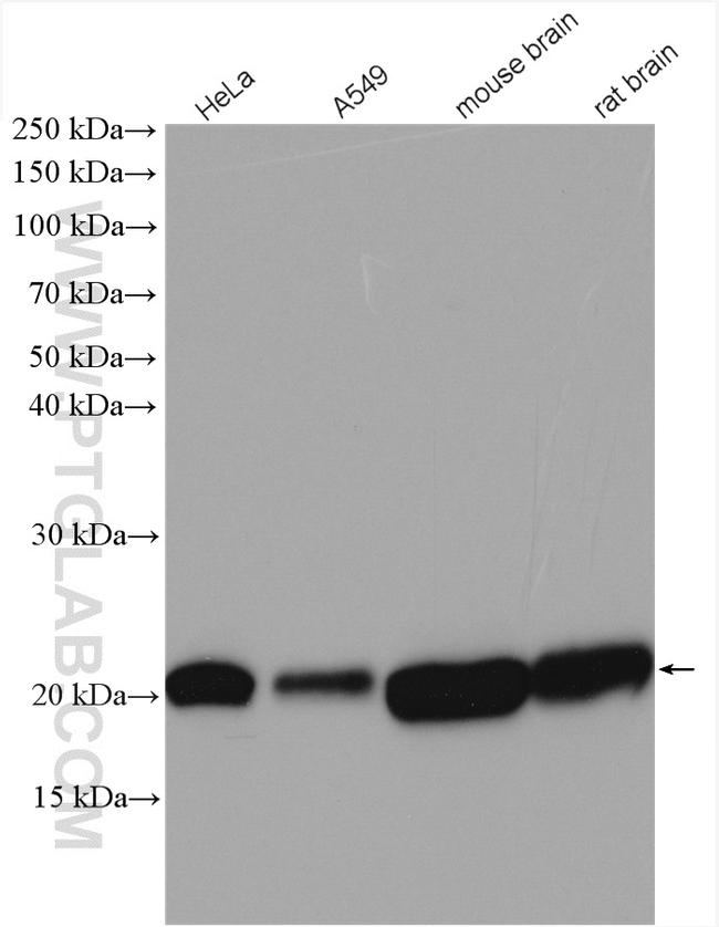 KRAS Antibody in Western Blot (WB)